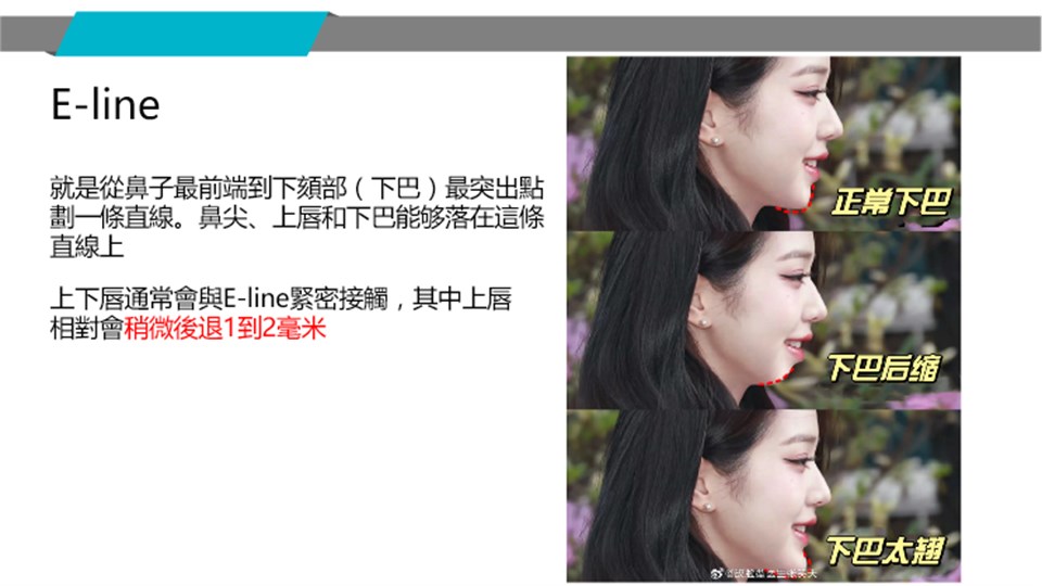 E-line下巴比例案例