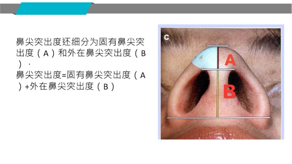 鼻尖突出度構成示意