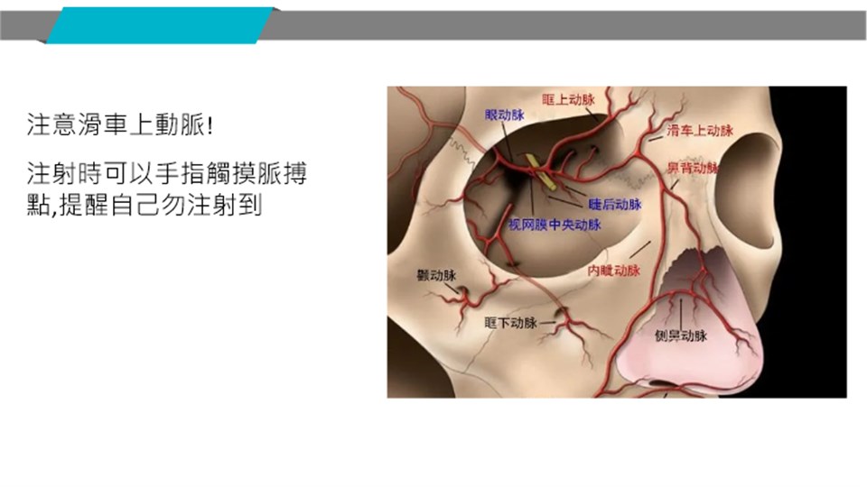 滑車上動脈解剖示意