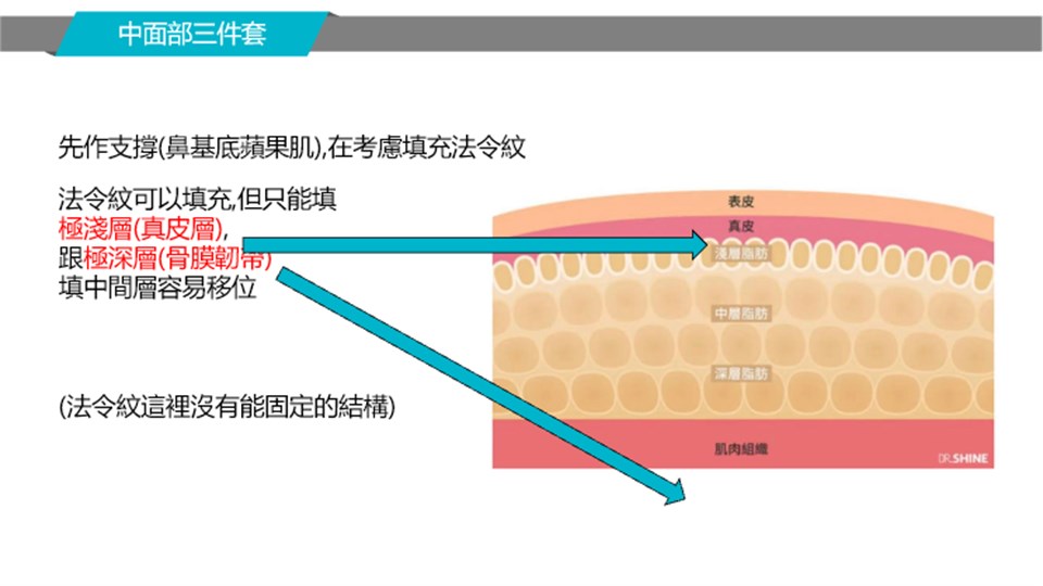 法令紋不同注射層次示意