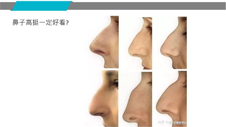 不同鼻型高度比較