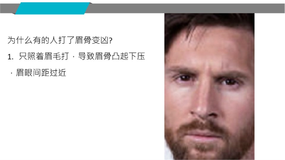 眉弓過高造成嚴肅感